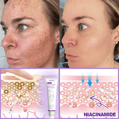 💎💎𝐕𝐢𝐭𝐚𝐥𝐢𝐬𝐲𝐬® 𝐏𝐃𝐑𝐍 𝐌𝐮𝐥𝐭𝐢-𝐏𝐞𝐩𝐭𝐢𝐝𝐞 𝐌𝐚𝐬𝐬𝐚𝐠𝐢𝐧𝐠 𝐁𝐨𝐝𝐲 𝐑𝐨𝐥𝐥𝐞𝐫 𝐂𝐫𝐞𝐚𝐦- 𝐀𝐧𝐭𝐢-𝐚𝐠𝐢𝐧𝐠, 𝐇𝐲𝐝𝐫𝐚𝐭𝐢𝐧𝐠, 𝐒𝐤𝐢𝐧 𝐅𝐢𝐫𝐦𝐢𝐧𝐠 & 𝐋𝐢𝐟𝐭𝐢𝐧𝐠, 𝐒𝐤𝐢𝐧 𝐑𝐞𝐩𝐚𝐢𝐫, 𝐄𝐯𝐞𝐧 𝐓𝐨𝐧𝐞, 𝐀𝐜𝐧𝐞 𝐚𝐧𝐝 𝐃𝐚𝐫𝐤 𝐒𝐩𝐨𝐭 𝐓𝐫𝐞𝐚𝐭𝐦𝐞𝐧𝐭, 𝐖𝐚𝐫𝐭 𝐚𝐧𝐝 𝐌𝐨𝐥𝐞 𝐑𝐞𝐦𝐨𝐯𝐚𝐥, 𝐚𝐧𝐝 𝐏𝐬𝐨𝐫𝐢𝐚𝐬𝐢𝐬 𝐑𝐞𝐥𝐢𝐞𝐟