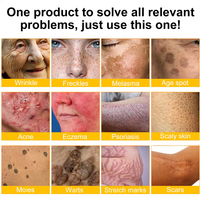 𝐕𝐢𝐭𝐚𝐥𝐢𝐬𝐲𝐬®🍇 Bee venom Pro Comprehensive Cream —Tightening for Skin Types 🔥