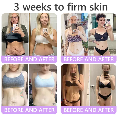 💎💎𝐕𝐢𝐭𝐚𝐥𝐢𝐬𝐲𝐬® 𝐏𝐃𝐑𝐍 𝐌𝐮𝐥𝐭𝐢-𝐏𝐞𝐩𝐭𝐢𝐝𝐞 𝐌𝐚𝐬𝐬𝐚𝐠𝐢𝐧𝐠 𝐁𝐨𝐝𝐲 𝐑𝐨𝐥𝐥𝐞𝐫 𝐂𝐫𝐞𝐚𝐦- 𝐀𝐧𝐭𝐢-𝐚𝐠𝐢𝐧𝐠, 𝐇𝐲𝐝𝐫𝐚𝐭𝐢𝐧𝐠, 𝐒𝐤𝐢𝐧 𝐅𝐢𝐫𝐦𝐢𝐧𝐠 & 𝐋𝐢𝐟𝐭𝐢𝐧𝐠, 𝐒𝐤𝐢𝐧 𝐑𝐞𝐩𝐚𝐢𝐫, 𝐄𝐯𝐞𝐧 𝐓𝐨𝐧𝐞, 𝐀𝐜𝐧𝐞 𝐚𝐧𝐝 𝐃𝐚𝐫𝐤 𝐒𝐩𝐨𝐭 𝐓𝐫𝐞𝐚𝐭𝐦𝐞𝐧𝐭, 𝐖𝐚𝐫𝐭 𝐚𝐧𝐝 𝐌𝐨𝐥𝐞 𝐑𝐞𝐦𝐨𝐯𝐚𝐥, 𝐚𝐧𝐝 𝐏𝐬𝐨𝐫𝐢𝐚𝐬𝐢𝐬 𝐑𝐞𝐥𝐢𝐞𝐟