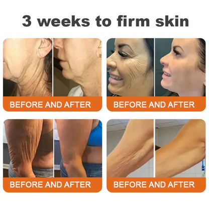 𝐕𝐢𝐭𝐚𝐥𝐢𝐬𝐲𝐬®🍇 Bee venom Pro Comprehensive Cream —Tightening for Skin Types 🔥