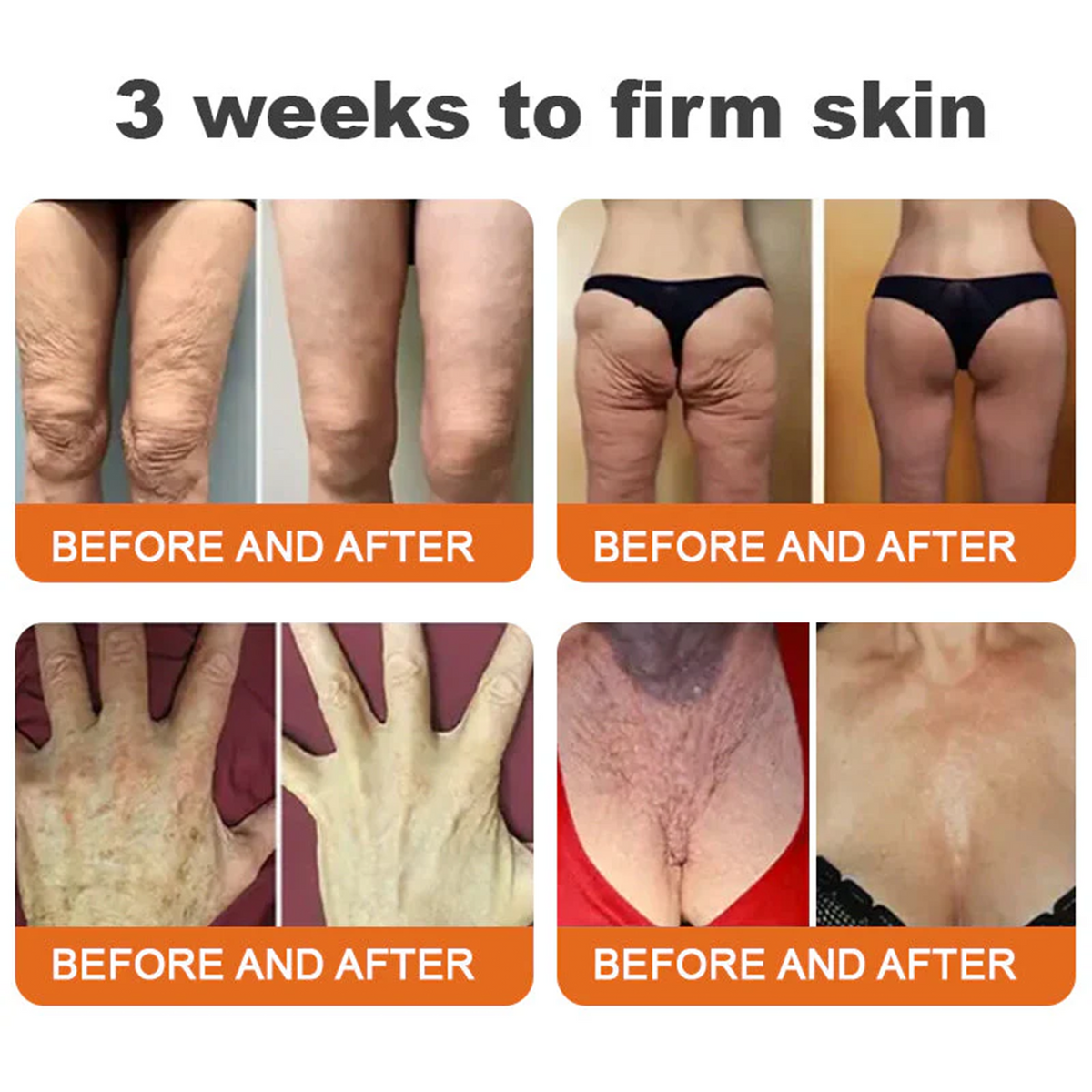 𝐕𝐢𝐭𝐚𝐥𝐢𝐬𝐲𝐬®🍇 Bee venom Pro Comprehensive Cream —Tightening for Skin Types 🔥