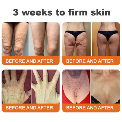 𝐕𝐢𝐭𝐚𝐥𝐢𝐬𝐲𝐬®🍇 Bee venom Pro Comprehensive Cream —Tightening for Skin Types 🔥